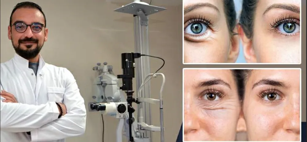 GÖZ KAPAĞI ESTETİĞİ AMELİYATLARI SAĞLIKLI VE GENÇ GÖRÜNÜM KAZANDIRIYOR